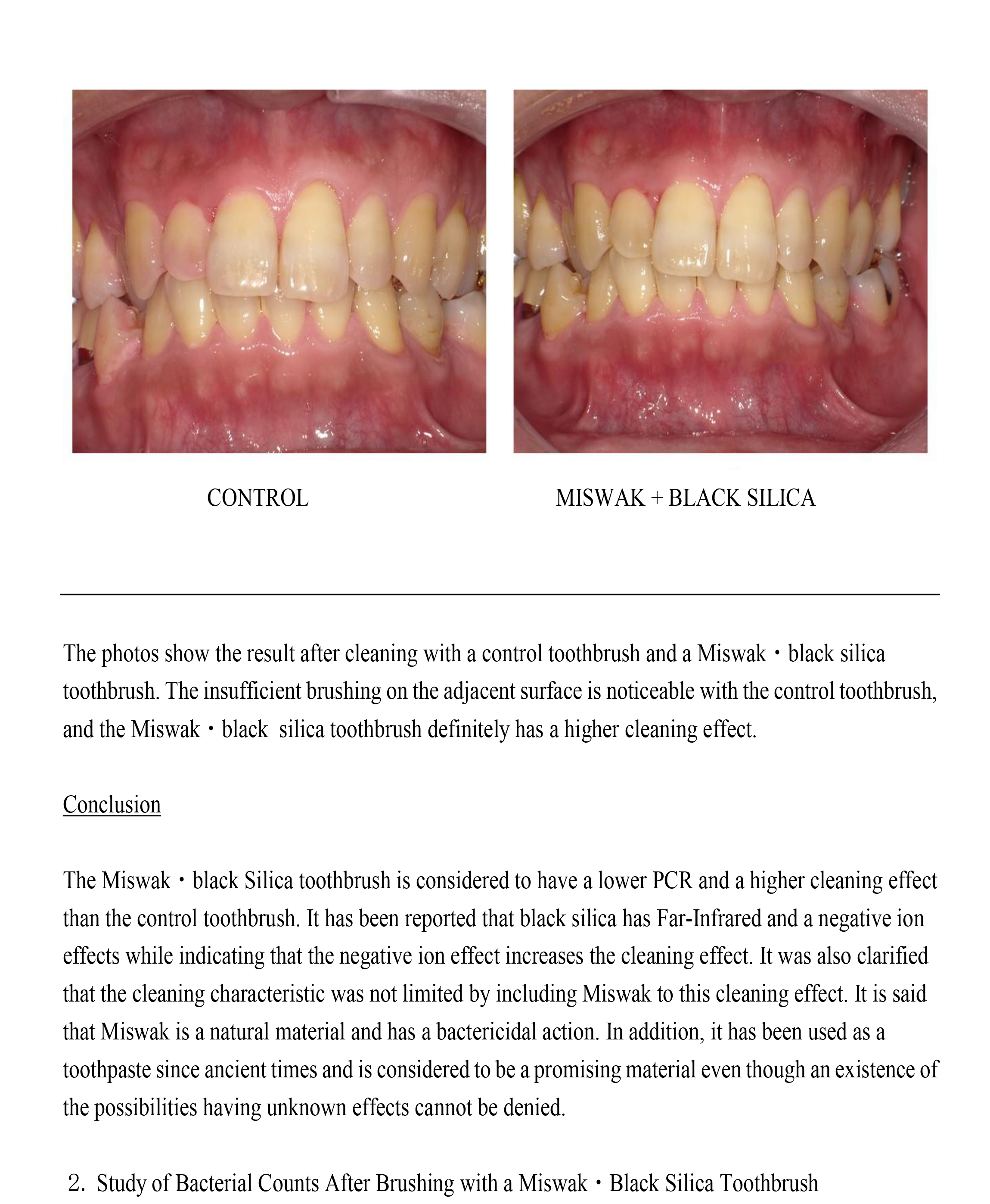 Kanagawa Dental University onderzoeksstudie